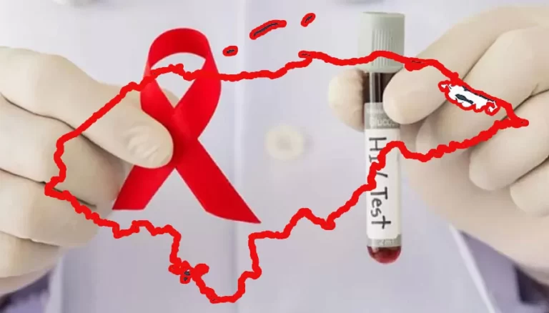 Día Mundial de la Respuesta ante la Epidemia de VIH: 3 nuevos casos de personas con VIH se detectan cada día en el país